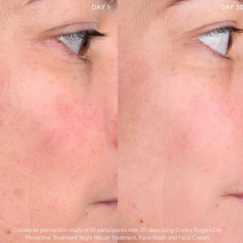 Advance Treatment Set