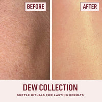 Travel Dew Collection